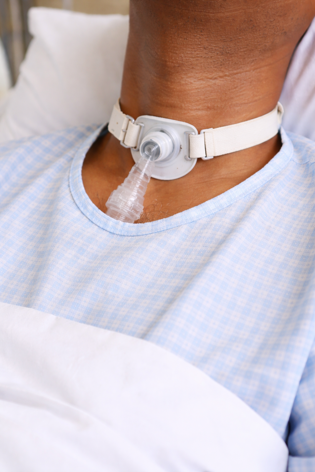 Ryles Tube Insertion